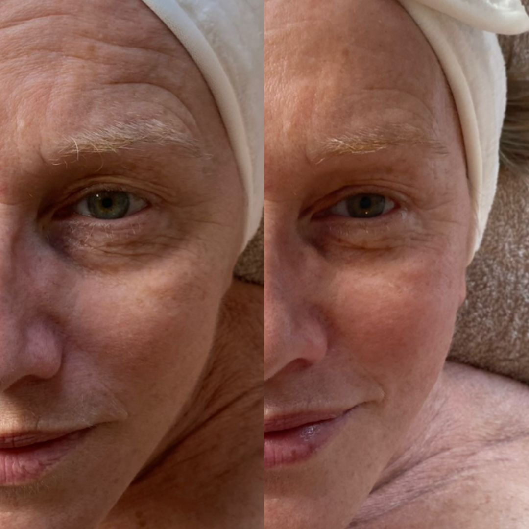 Avant/après soin visage